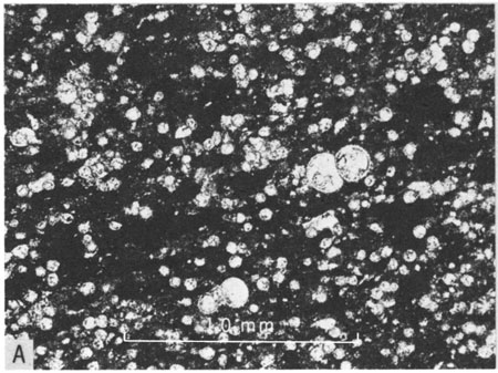 Photomicrograph, Fencepost limestone bed.