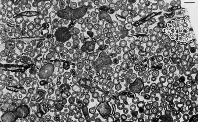 Black and white photo of thin section.