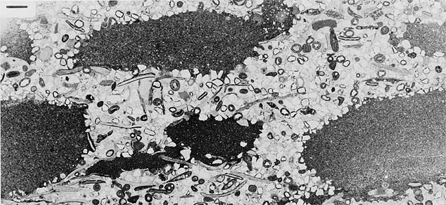 Black and white photo of thin section.