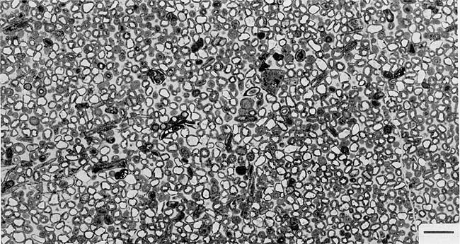 Black and white photo of thin section.