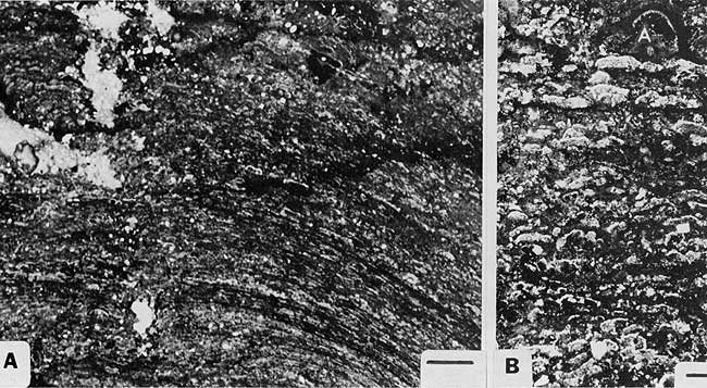 Black and white photos of thin section and closeup.