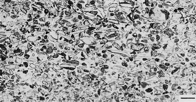 Black and white photo of thin section.