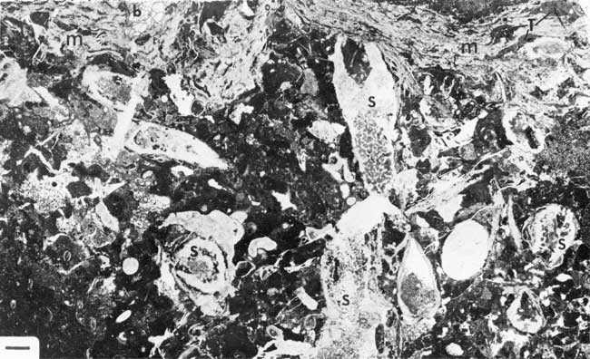 Black and white photo of thin section.