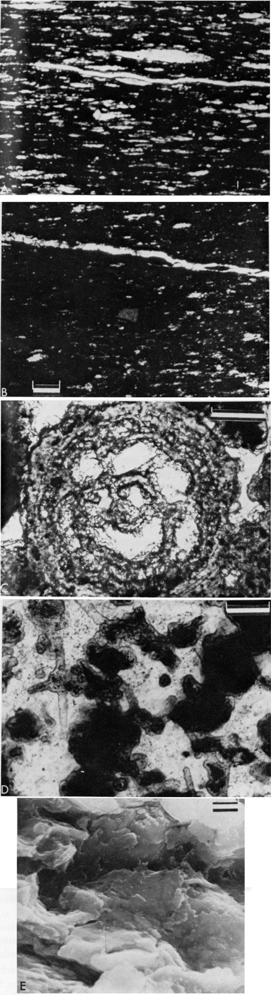 Five black and white images of thin sections or of electron photomicrographs.