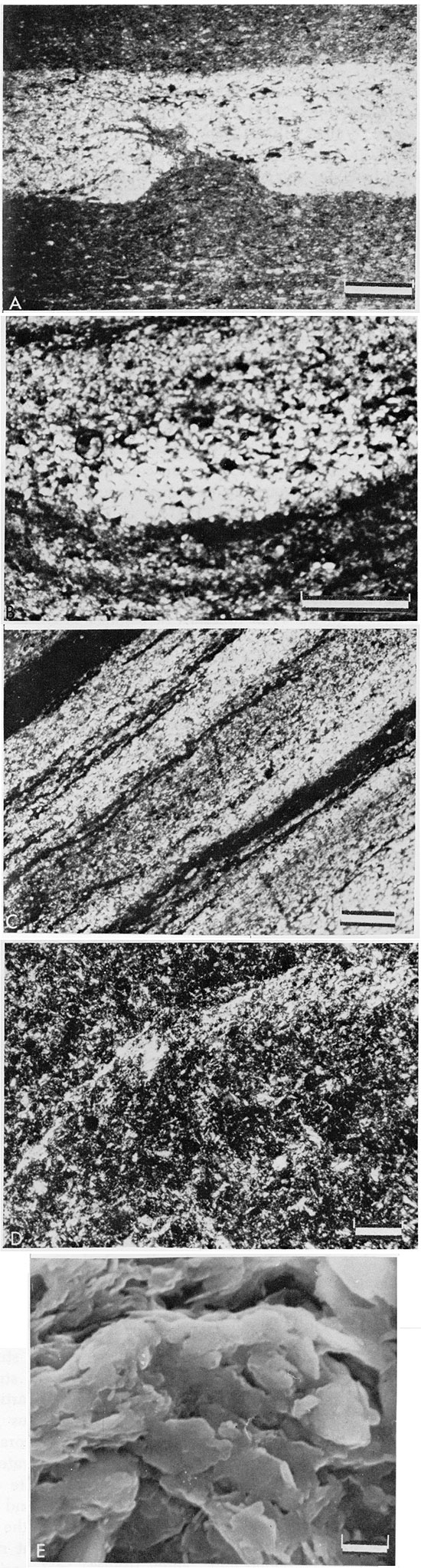Four black and white photomicrographs and one electron photomicrograph.