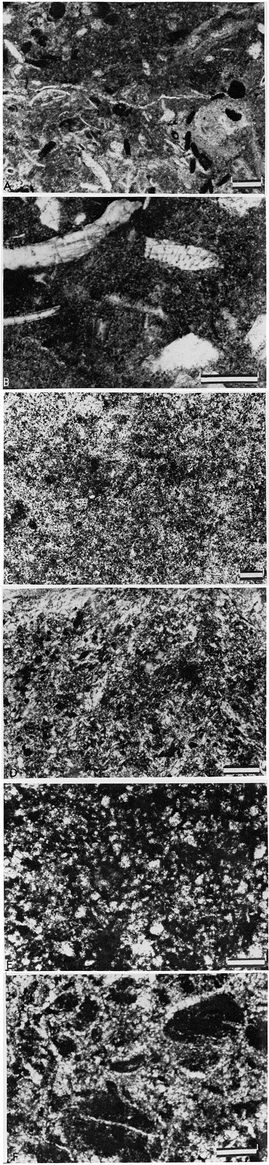 Six black and white photomicrographs.