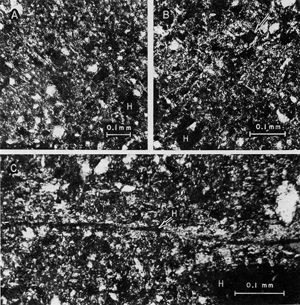 Three black and white photomicrographs.