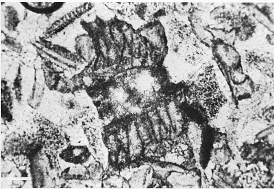 Black and white photomicrograph.