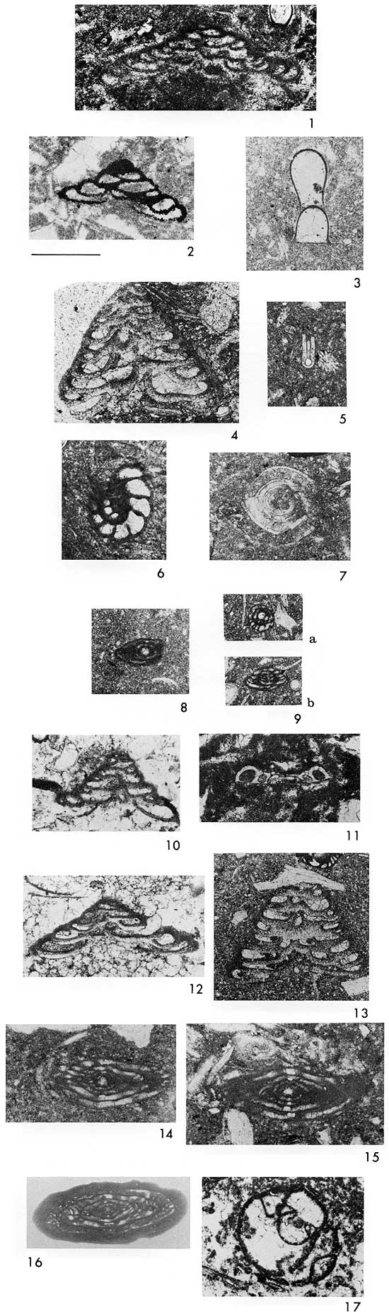 Black and white photos of microfossils in thin sections.