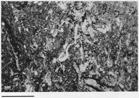 Black and white photomicrograph.