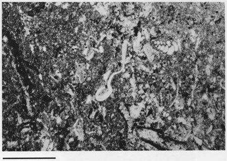 Black and white photomicrograph.