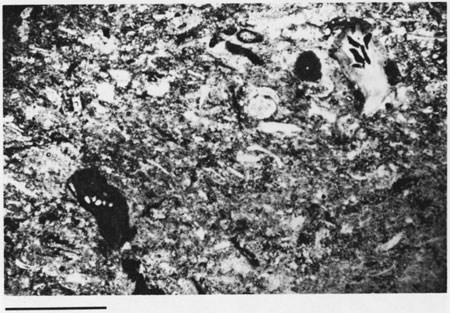 Black and white photomicrograph.