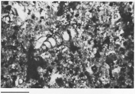 Black and white photomicrograph.