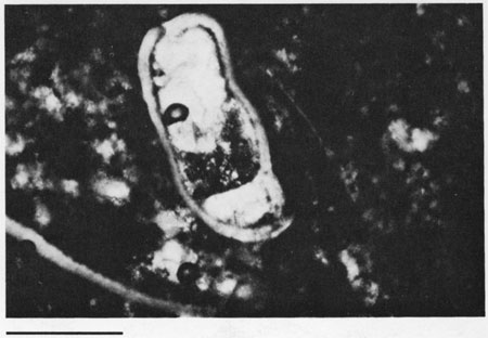 Black and white photomicrograph.