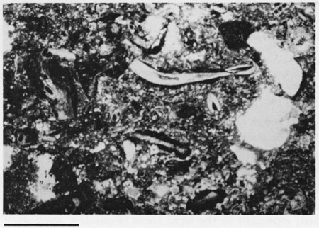 Black and white photomicrograph.