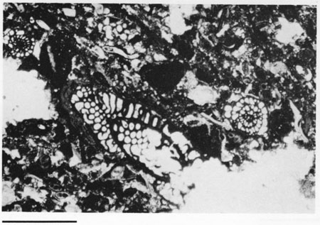 Black and white photomicrograph.