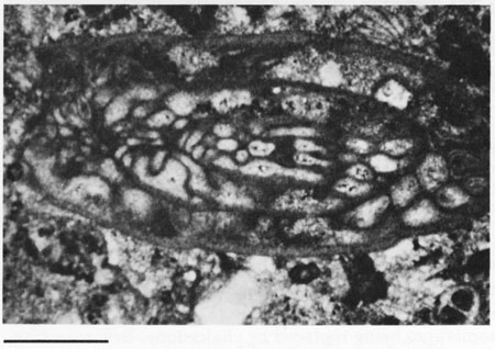 Black and white photomicrograph.