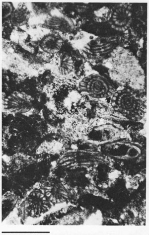 Black and white photomicrograph.