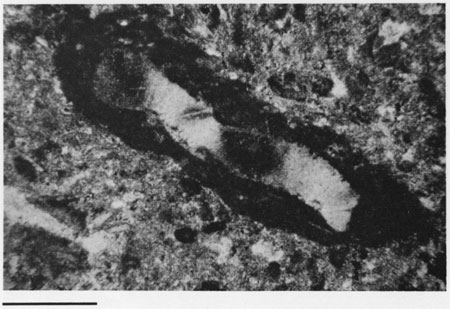 Black and white photomicrograph.