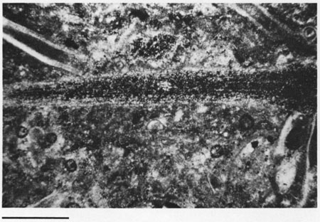 Black and white photomicrograph.