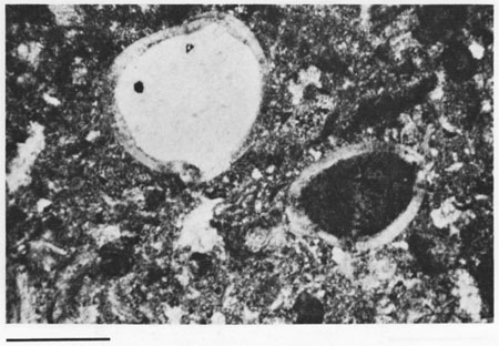 Black and white photomicrograph.