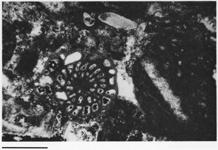 Black and white photomicrograph.