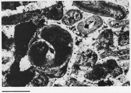 Black and white photomicrograph.