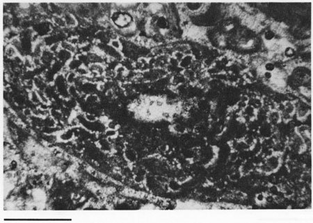 Black and white photomicrograph.