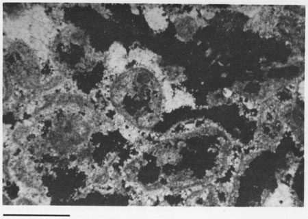 Black and white photomicrograph.