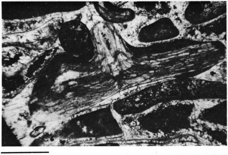 Black and white photomicrograph.