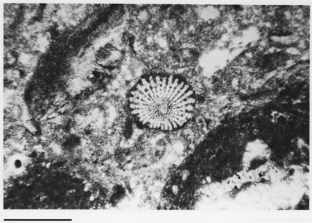 Black and white photomicrograph.