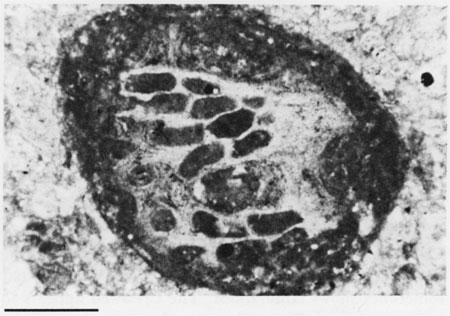 Black and white photomicrograph.