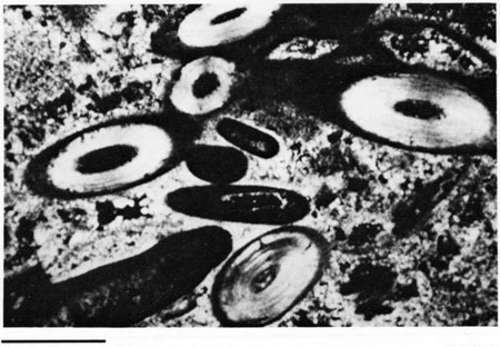 Black and white photomicrograph.