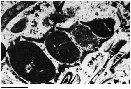 Black and white photomicrograph.