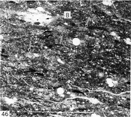 Black and white micrograph of granular chalk, Logan County.