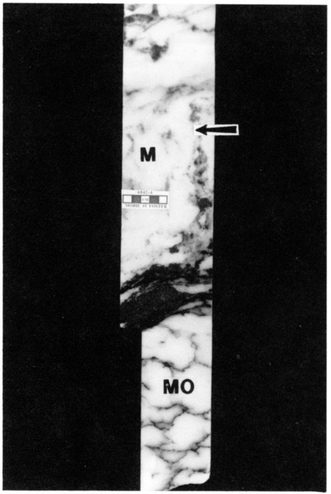 Anhydrite textures from the E1 anhydrite of the Hugoton Member in the Mobil #1 Foster.