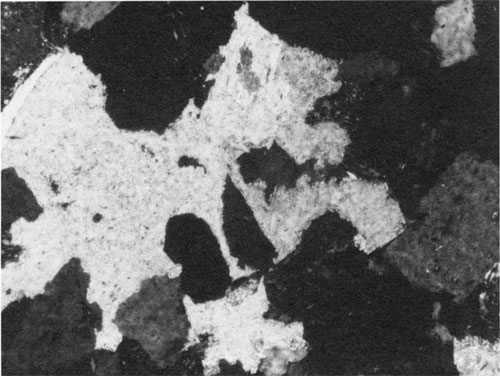 Black and white photomicrograph.