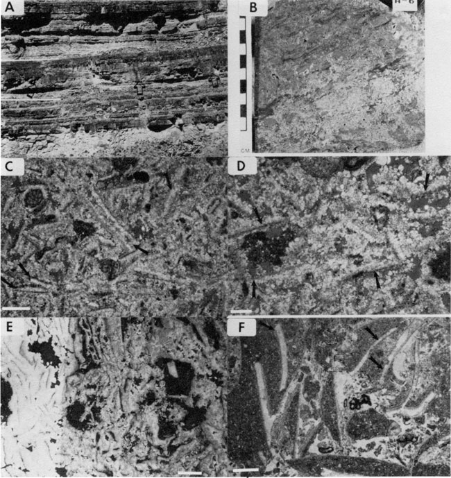 Six black and white photos; four are photomicrographs; others are outcrop and core samples.