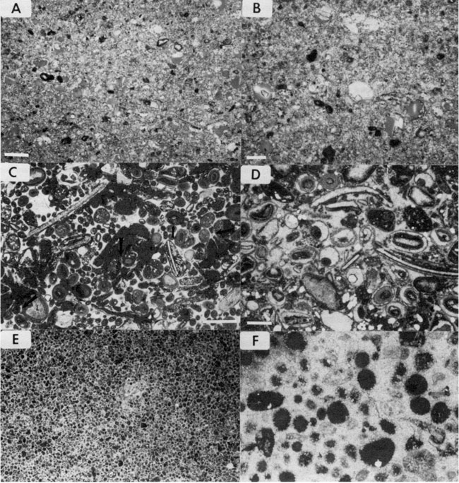 Six black and white photomicrographs.