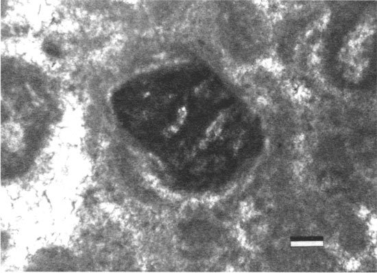 Black and white photomicrograph.