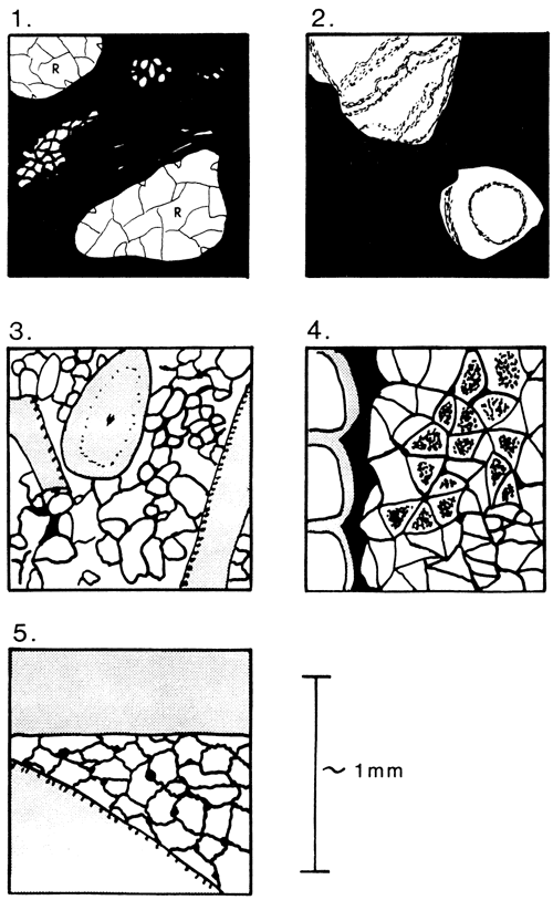 Sketch shows five types of alveolar texture, on scales of millimeters.