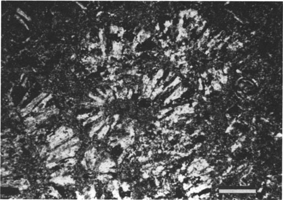 Black and white photomicrograph.
