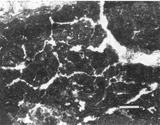 Black and white photomicrograph.