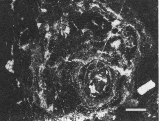 Black and white photomicrograph.