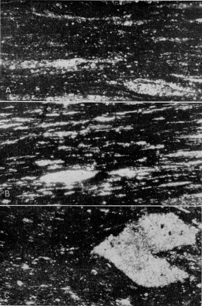 Three black and white photomicrographs.