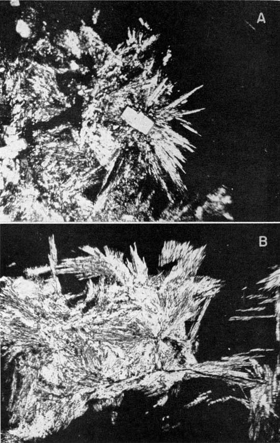 Two black and white photomicrographs.