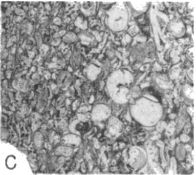 photomicrograph 1c