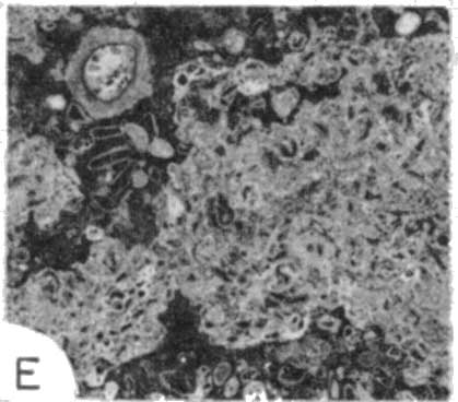 photomicrograph 1e