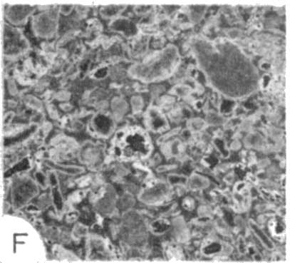 photomicrograph 1f