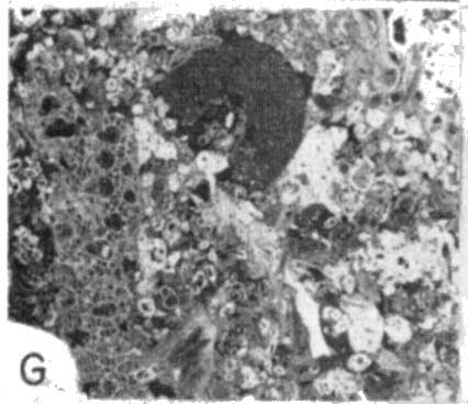 photomicrograph 1g